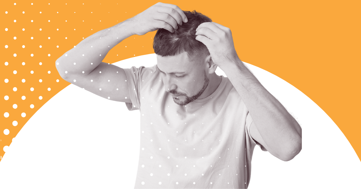 hair loss treatment